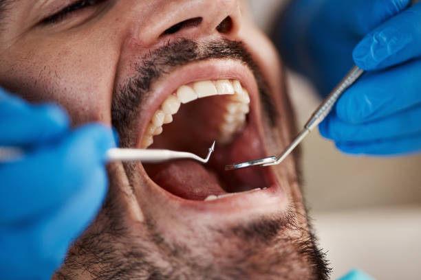 Best Urgent Care for Lost Fillings or Crowns in Ocean Gate, NJ